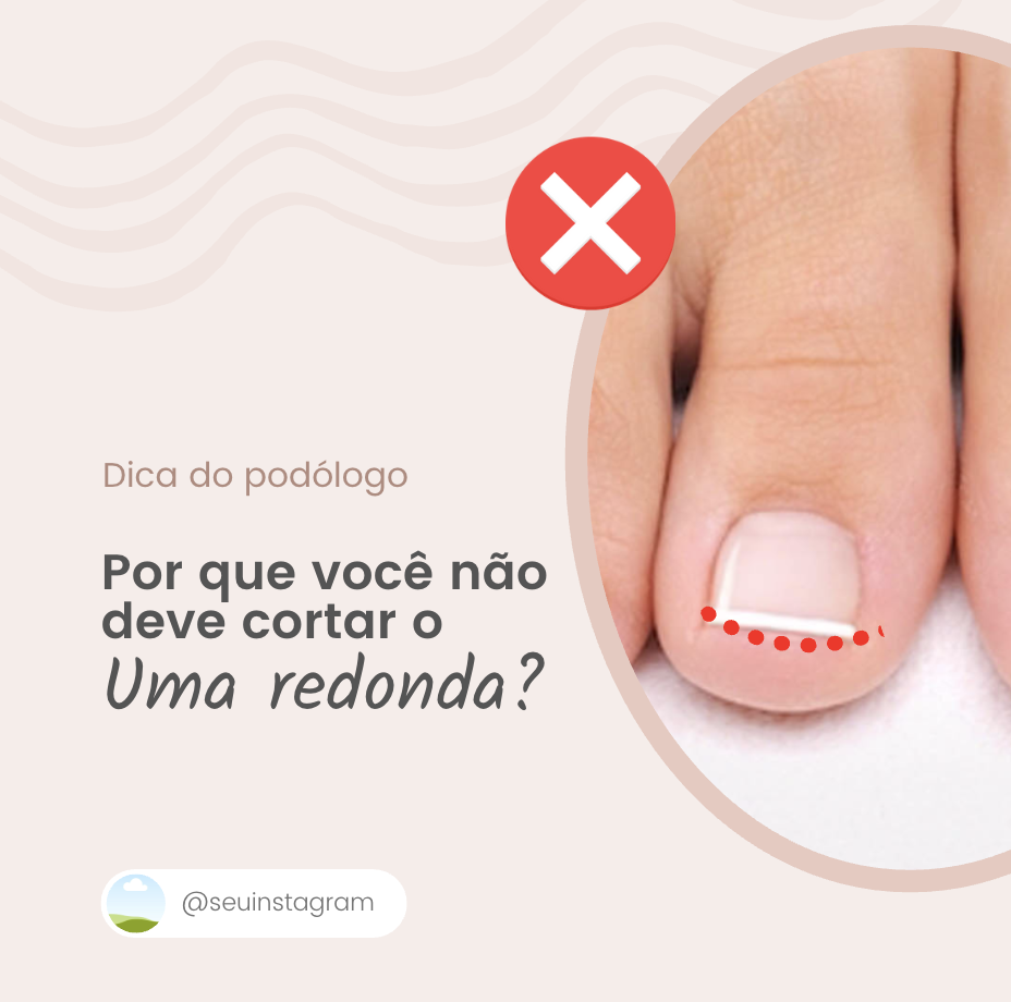 Template de post para Podologia